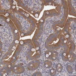 Chitobiase/CTBS Antibody, Novus Biologicals 0.1 mL | Buy Online | Novus Biologicals | Fisher Scientific